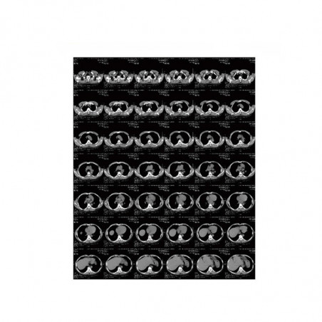 MEDICAL THERMAL FILM