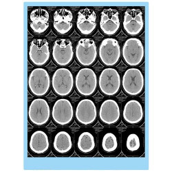 MEDICAL THERMAL FILM